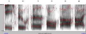 Vowels-spectrogram-british-english-adult-male.jpg