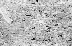 BDV Immunohistologic analysis.gif