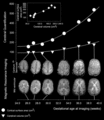 Thumbnail for version as of 19:56, 11 March 2022