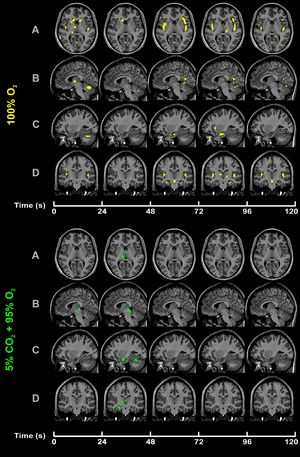 CO2-O2-fMRI-all-over-time.png